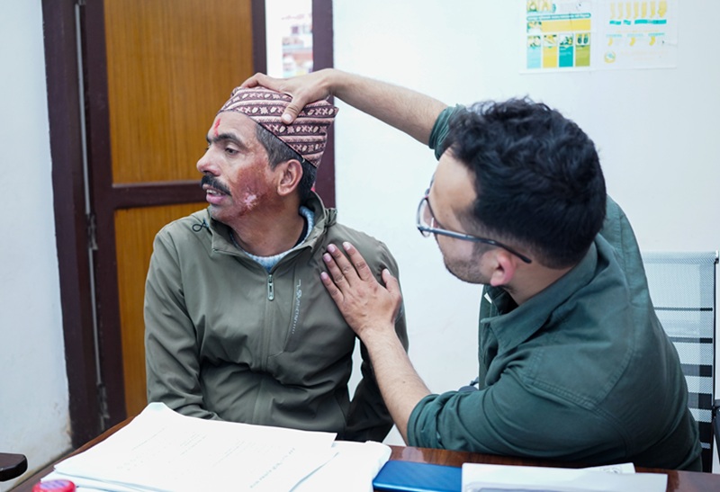 Nabil Bank Free Burn Treatment