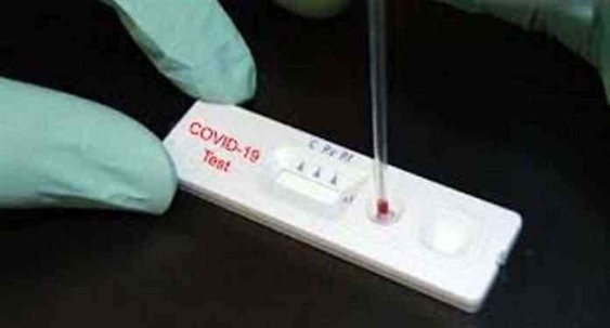 Two People Test Positive For Coronavirus In RDT